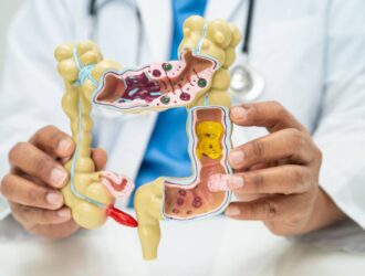 Intestine, appendix and digestive system, doctor holding anatomy model for study diagnosis and treatment in hospital.